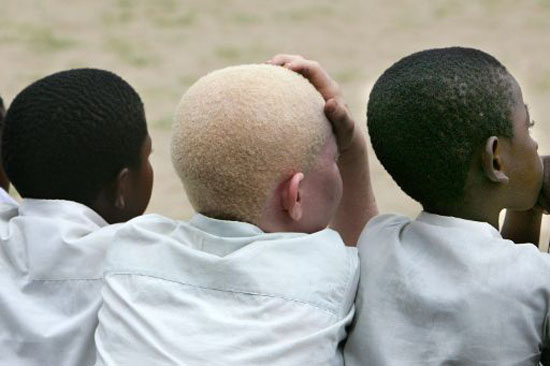 albinosi